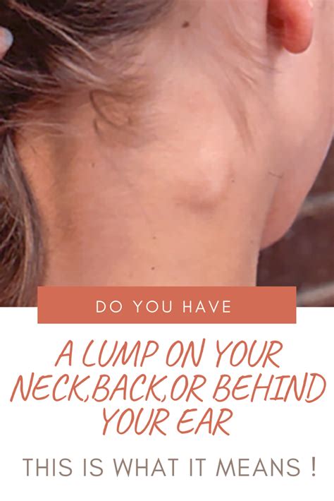 do you have a lump on your neck back or behind your ear here is what my xxx hot girl