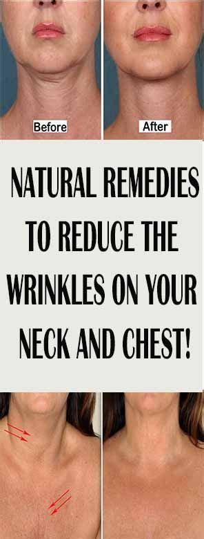 Natural Remedies To Reduce The Wrinkles On Your Neck And Chest