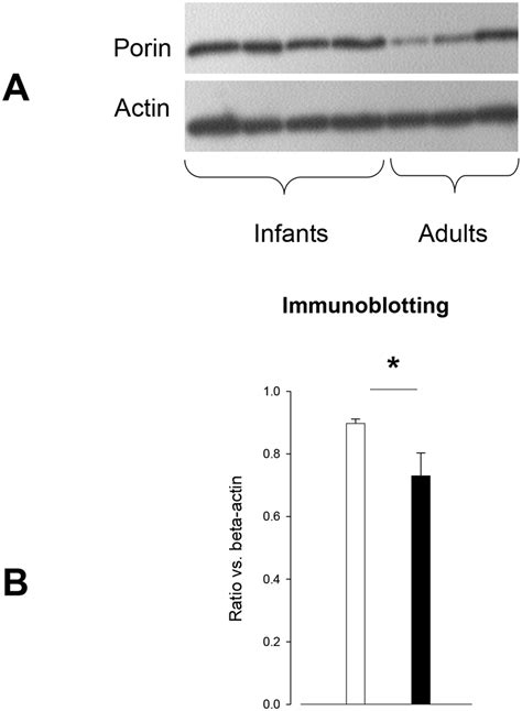 Porins are beta barrel proteins that cross a cellular membrane and act as a pore through which molecules can diffuse unlike other membrane transport protein. Porin expression according to age groups. A. Immunoblot for porin and... | Download Scientific ...
