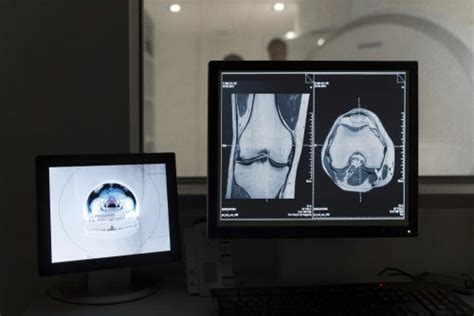 Kutrrh Spect Ct Bone Scan Now Available Imaging Imic Kenyatta