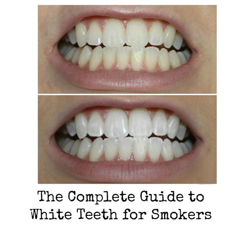 how to get rid of coffee and cigarette stains on teeth reverasite