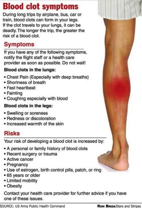 Blood Clot In Leg Symptoms