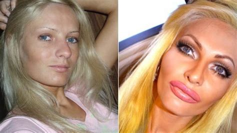 Model Spends Thousands On Plastic Surgery To Look Like A Sex Doll Says Shes Happy And