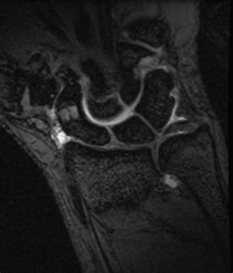 Clinical Evaluation Of The Painful Wrist And Hand