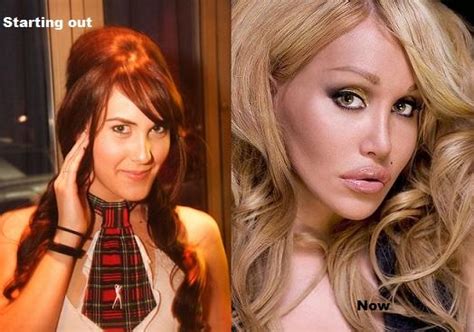 Shocking Cosmetic Surgery 10 Procedures That Cost A Fortune