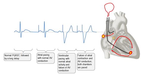 Randys Ekg Website