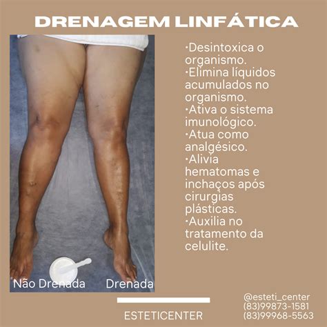 Drenagem Linfática saiba seus benefícios e indicações Lymphatic