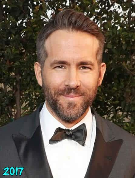 Ryan Reynolds Plastic Surgery Hair Transplant Teeth Fix Nose Job