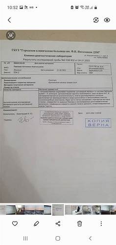 Диета при аит гипотериоз Сердечно-сосудисты проблемы при гипотериозе, АИТ, раке щитовидной Сердечно-сосудисты проблемы при гипотериозе, АИТ, раке щитовидной Диета при аит гипотериоз