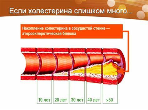 Повышенный холестерин диета рецепты Повышенный холестерин: зачем и как с ним бороться - online presentation Повышенный холестерин: зачем и как с ним бороться - online presentation Повышенный холестерин диета рецепты
