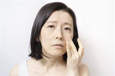 Middle Aged Woman Suffering From Skin Problems Stock Photo Image Of