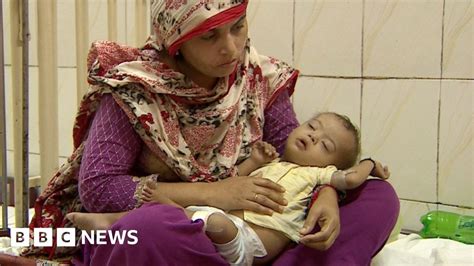 Why Pakistan Is Struggling To Heal Young Heart Patients Bbc News
