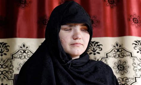 seorang wanita afghanistan yang bekerja sebagai polisi ditembak dan ditusuk di bagian mata saat