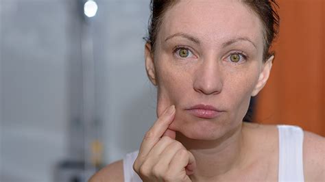 How To Get Rid Of Jowls Without Surgery
