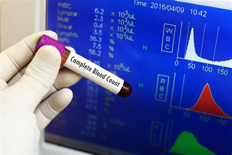 Complete Blood Count The Reference Range In Male And Females