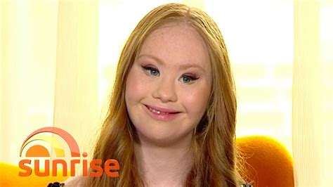 The Worlds First Professional Model With Down Syndrome Sunrise YouTube