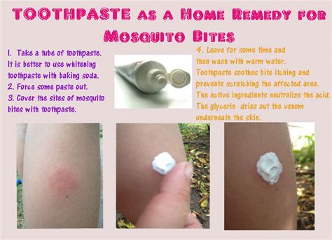 Itch Relief For Mosquito Bites And Swellings