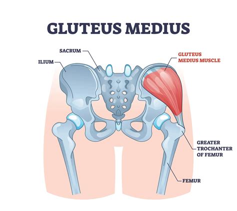 Gluteus Medius Tear Treatment In Columbus Oh Orthoneuro