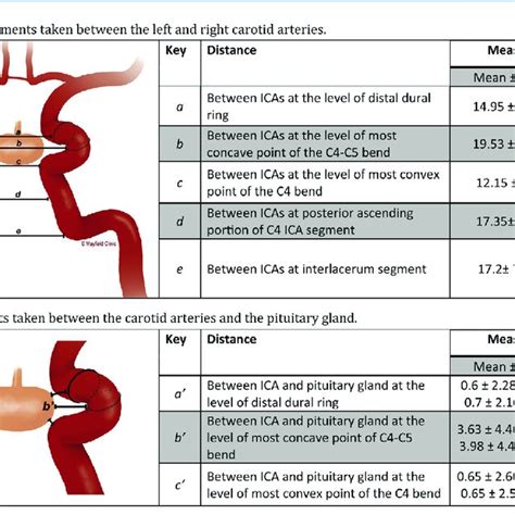 Anatomic Measurements Between The Internal Carotid Arteries And The