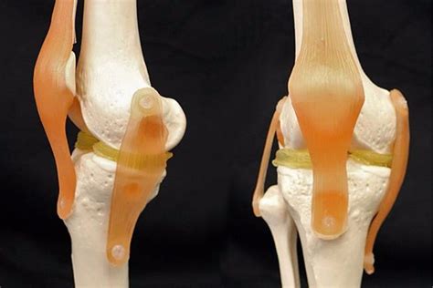 Cartilage Like Hydrogel Promises 3d Printable Knee Implants