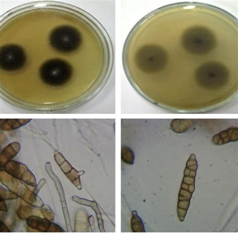 Antimicrobial Activities Of Fungal Endophytes Isolated From Asclepias