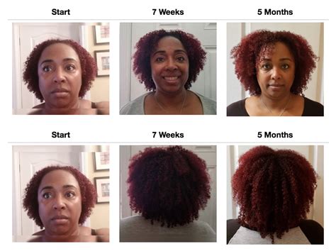 Month Hair Growth Natural Hair Ubicaciondepersonascdmxgobmx