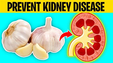 Eat These 9 Foods To Prevent Kidney Disease Youtube