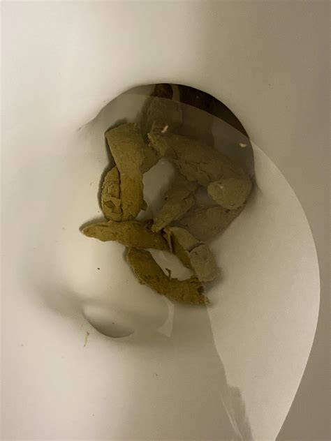 What does an orange colored sign indicate. I've been having some light colored poop lately. Does this ...