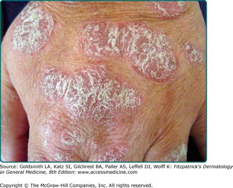 Structure Of Skin Lesions And Fundamentals Of Clinical Diagnosis