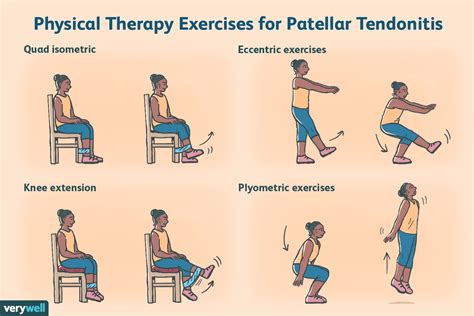 Exercises For Patellar Tendonitis