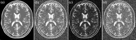 An Example Of T2 Image A Original T2 Weighted Mri B 17 Noisy T2