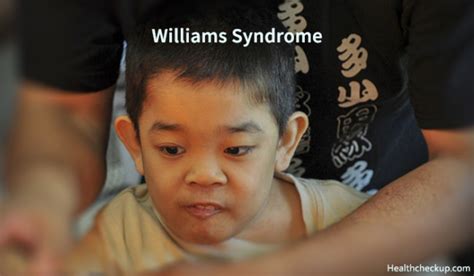 Williams Syndrome Life Expectancy Causes Symptoms Treatment