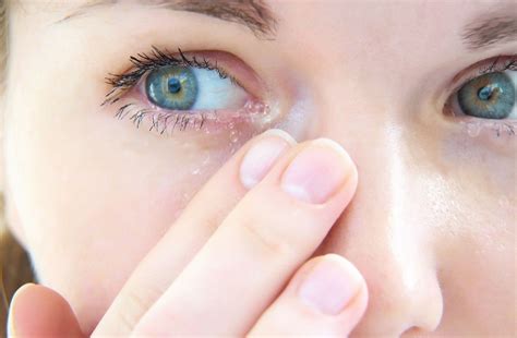 Watery Eyes How To Get Clear Vision Healthwire