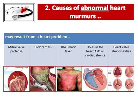 the heart systolic murmur