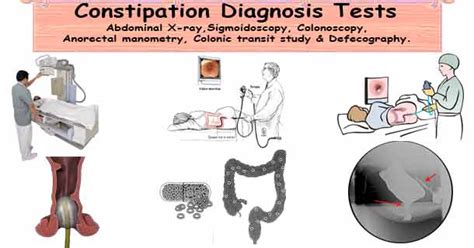 Diagnosis Of Constipation Physical Examination And Diagnosis Test For