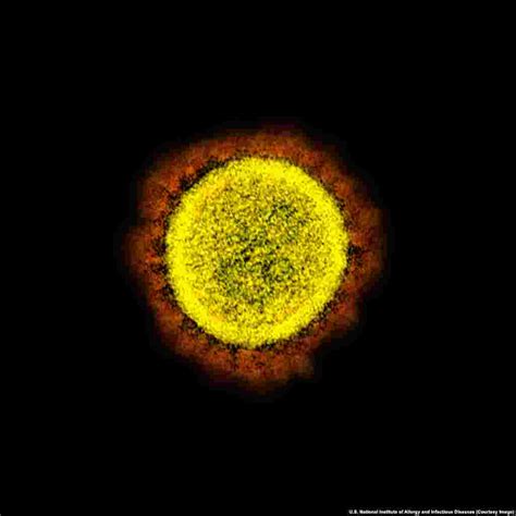 Up Close With The Enemy The Coronavirus In Stunning Detail