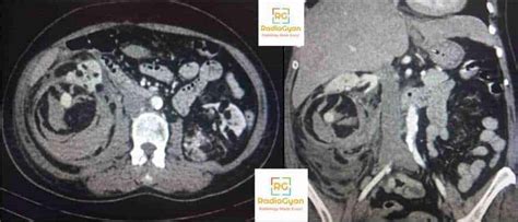 Neuroradiology Cases Radiology Spotters Set 27 RadioGyan