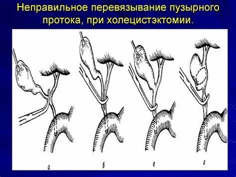 Диета 5 при холецистэктомии Желчнокаменная болезнь - презентация онлайн Желчнокаменная болезнь - презентация онлайн Диета 5 при холецистэктомии