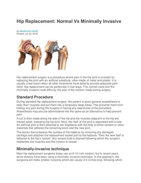 Hip Replacement Normal Vs Minimally Invasive