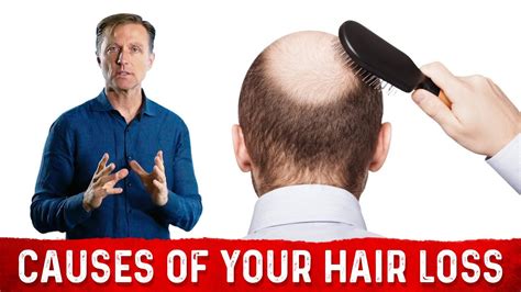 The Underlying Root Cause Of Hair Loss Treatment For Hair Loss Dr