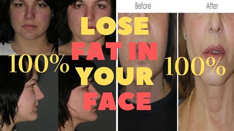 It's one of the first things people notice about your weight loss when you go outside. How to lose face fat fast in a week - With 7 Effective Tips - YouTube