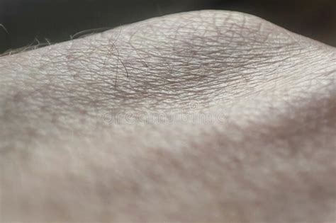 Closeup Human Skin Texture Macro Hand Skin Pattern Medicine And