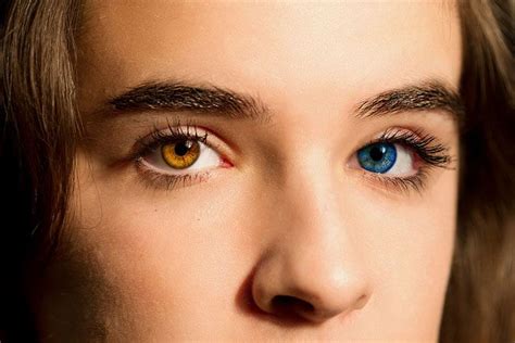 ¡cambia El Color De Tus Ojos Cadena Dial Ojos Increíbles Ojos Heterocromía