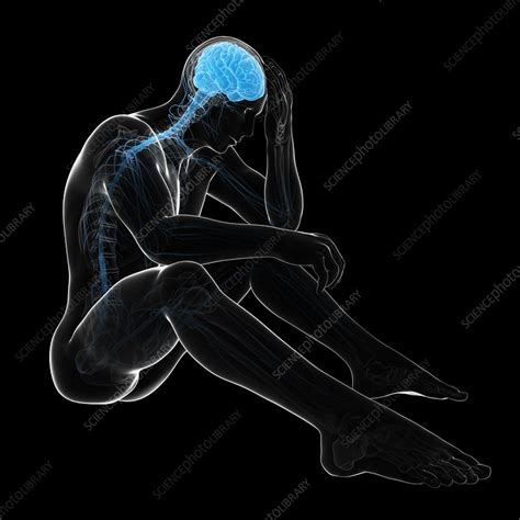 Depression Conceptual Artwork Stock Image F0062823 Science