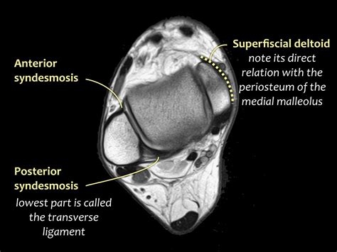 Mri Ankle Ligament Axial 3 Diagram Quizlet