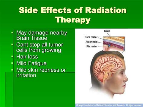 Ppt Meningiomas Benign Atypical And Malignant Or Anaplastic Powerpoint Presentation Id