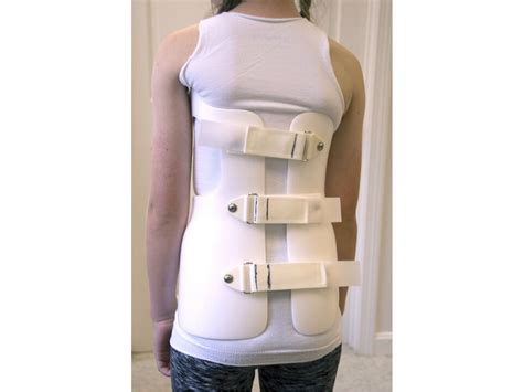 Spinal Technology Full Time Scoliosis Orthosis Wear And Care