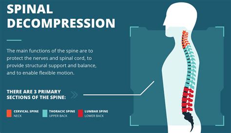 Spinal Decompression Therapy Feat Palmetto Chiromed