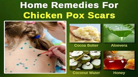 Home Remedies To Get Rid Of Chicken Pox Scars