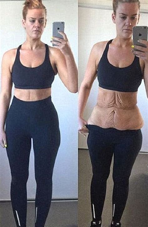Weight Loss Loose Skin Women Weightlol